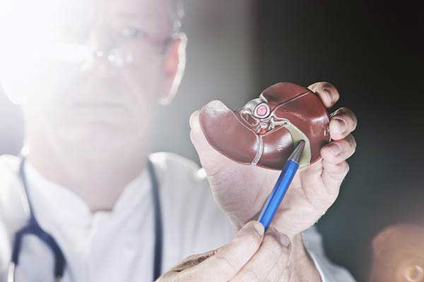 Understanding Gallstones & When Surgery is Needed