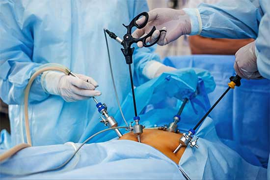 Lap Cholecystectomy